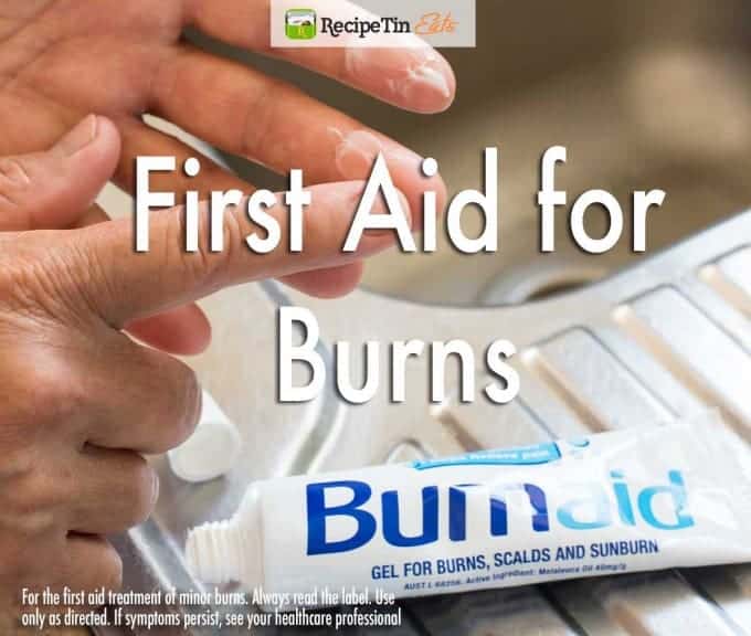 First-Aid-for-Burns_v2GydF4y2Ba